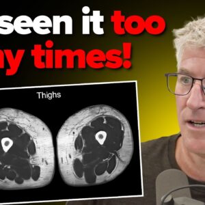 Visceral Fat Scientist Reveals Leg Fat More Dangerous than Belly Fat - Dr. Sean O’Mara