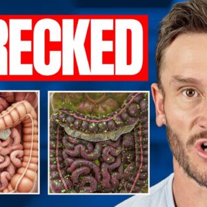 The 9 Most Inflammatory Foods for Your Gut You Could Ever Eat