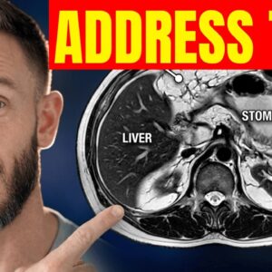 Visceral Fat is Literally Shrinking Your Brain - This Stops it